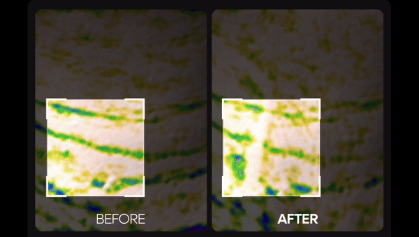 Dr.Melaxin Necklinephalt Tightening Cream - zpevňující krém na krk s bio-spiculemi 20g (1)